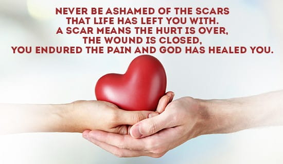 Never be ashamed of your scars... ecard, online card