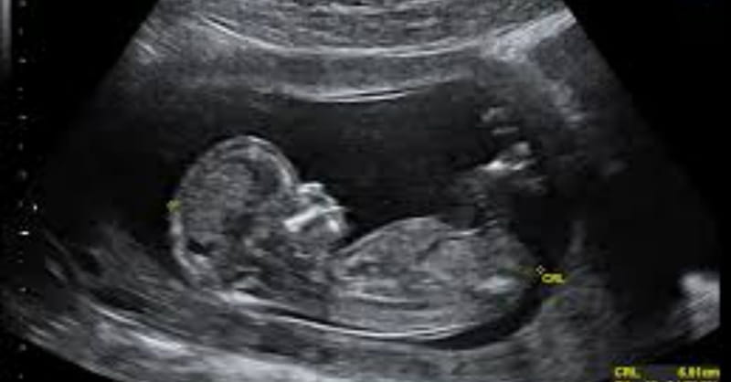 Judge's Impartiality Questioned in Abortion Video Case