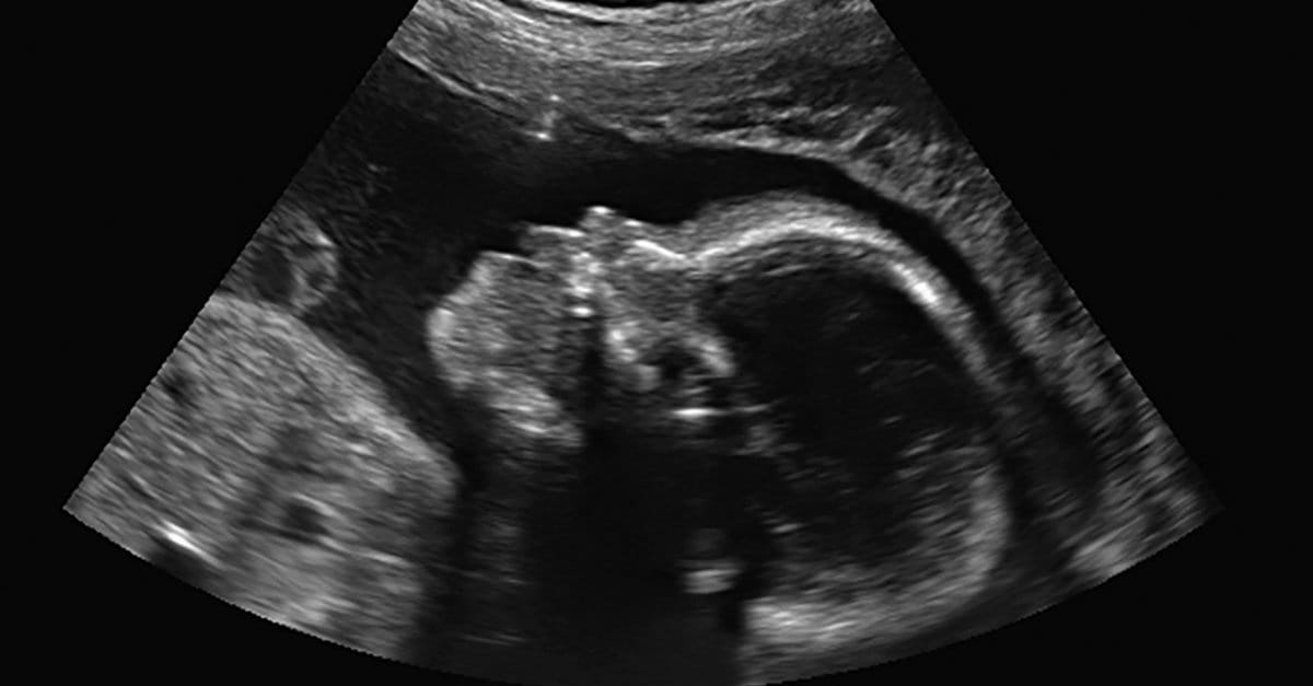 10 Things You Should Know about Abortion