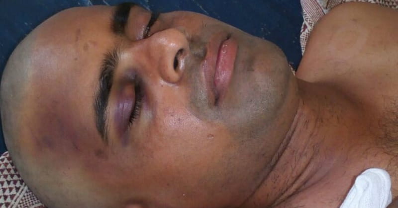 Hindu Extremists Beat Pastor Unconscious in Southern India after 'Miraculous' Conversions