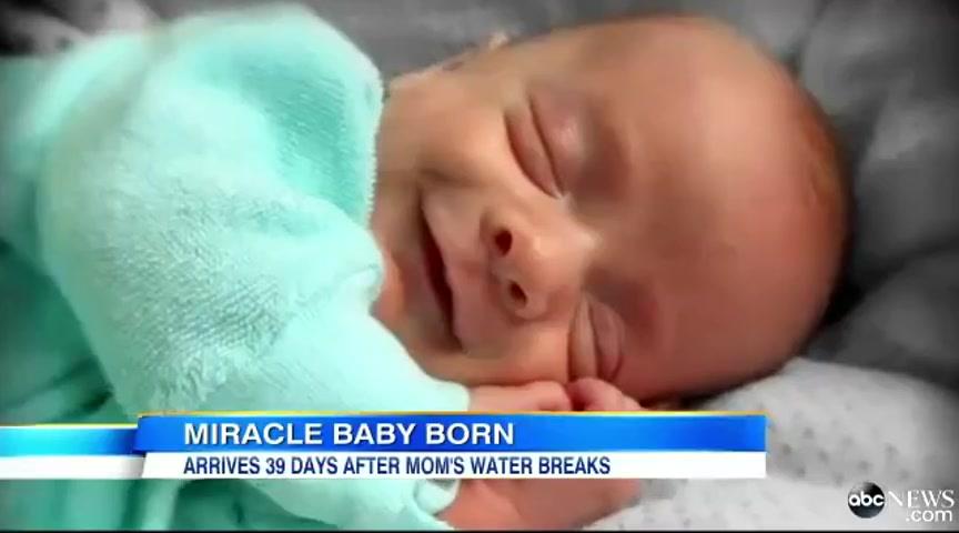 39 Days After Her Water Broke, This Mother Finally Gave Birth. Her ...