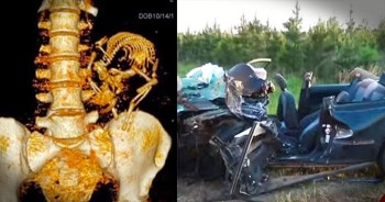 Aimee Eckert had a rare day off of work, so she decided to meet some friends. But her springtime drive was cut short when another driver hit her head on. This second driver was texting and speeding. Not only was Aimee severely injured, but the life of her unborn child was lost forever. Please, please put an end to texting and driving.