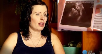 Mom Of Conjoined Twins Turns To Prayer To Cope