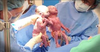 Jenna and Jillian were rare mono mono twins. Despite their survival being in question, these twins arrived safe and sound holding each other’s hand. Happy birthday sweet babies!