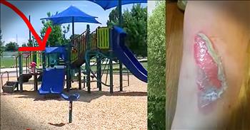 This mother was in shock when her little girl went down the slide at an Albuquerque park and ran over screaming. The plastic side became so hot in the sun that this mom's 2-year-old daughter was burned. Now this mother is warning other parents to be aware of this danger as summer approaches and temperatures rise. 
