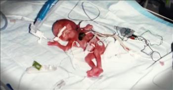 Eric and Tammy Koz were young and in love and desperately wanted to be parents. They were heartbroken when they found out that their baby girl Zoe stopped growing at only 19 weeks. Doctors feared she would die and Tammy had to go to the hospital every other day to check for a heartbeat. Finally doctors delivered the tiny baby girl with less than a 5% chance of survival and were stunned as Zoe kept fighting for life. That was 12 year ago and this miracle baby is now a strong young girl. And you've got to see her now!