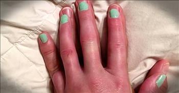 Libby Sanders lost her pinky finger in a freak accident in 2016. One day she became upset when she was painting her fingernails and realized she did not have a pinky nail to paint. Her loving husband, Matt, decided that he would be her 'surrogate' pinky and every time she went to do her nails, she would paint his pinky. This small symbol is a testament to the love between this sweet couple and it makes my heart leapt with joy.