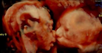 Carissa Gill had seen her twin baby girls before through ultrasound. But when she went in for one check up they saw something beyond beautiful. Carissa's baby girls were giving each other kisses! When you see the photos your heart will be so full. What incredible little miracles.