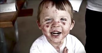 Young Jonah has Epidermolysis Bullosa, an illness that causes his skin to be extremely fragile and blister with the slightest touch. As his parents struggled to come to terms with his illness, they turned to prayer. And hearing the love and happiness that this family brings to Jonah is exactly why God put him right where he needed to be. 