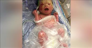 A little girl born with a rare skin condition that caused her skin to crack is now thriving. Throughout pregnancy, Jennie Wilklow was told that she had a healthy baby girl. But during her c-section surgery, the doctor’s informed Jennie and her husband that their newborn had a birth defect.  Jennie remembers her husband remarking on the situation, “He just said, ‘It’s bad, it’s just bad. But I looked into her eyes and she has the most beautiful soul.’” 

Little Anna Wilklow was born with a condition called harlequin ichthyosis. It is a genetic condition that doesn’t allow the last layers of skin to develop correctly. This causes the skin to harden and crack shortly after birth. “She was crying. She was in pain and her skin became hard like leather,” Jennie said. 

Anna spent over a month in an incubator to heal, but now the 15-month-old is a happy and healthy toddler. There are still some precautions that the family must take, such as being aware of extreme temperatures and long baths every single day. And as her skin rapidly reproduces, Anna’s appetite greatly increases. In fact, this sweet toddler consumes over 2,100 calories a day, more than the average adult.  

But overall, this precious little girl is thriving at home and with her 2 older brothers. Even though life may never be ‘normal’ for Anna, her family knows that she is absolutely perfect just the way she is. “She’s more than her disease,” Jennie said. What an inspiring little girl!