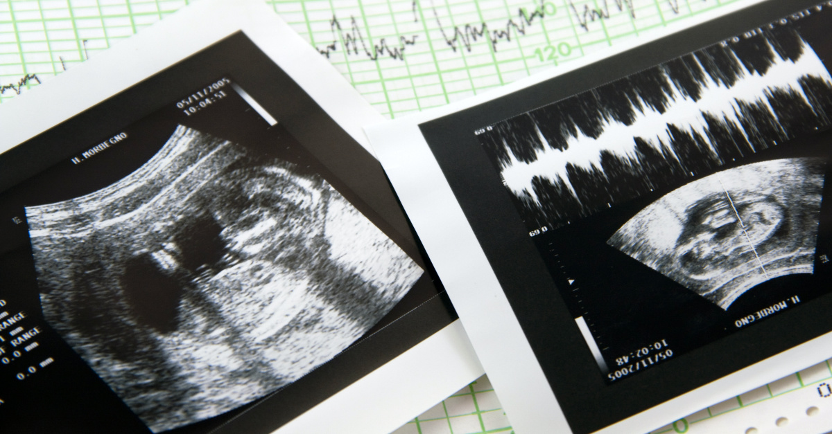 Arizona Senate Advances Bill Banning Abortions after 15 Weeks of Pregnancy